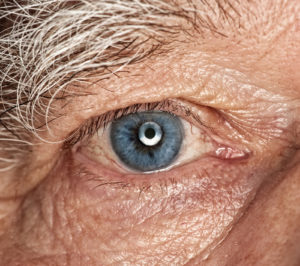 Senior Care in Fairmont MN: Eye Health